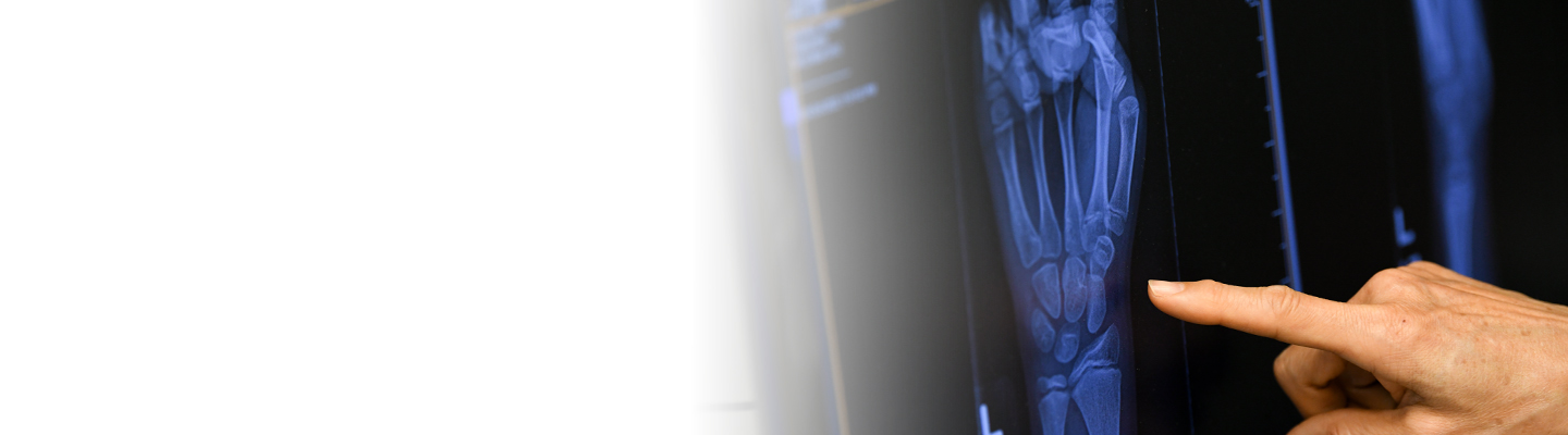A rheumatologist pointing to a close-up of a hand X-ray.