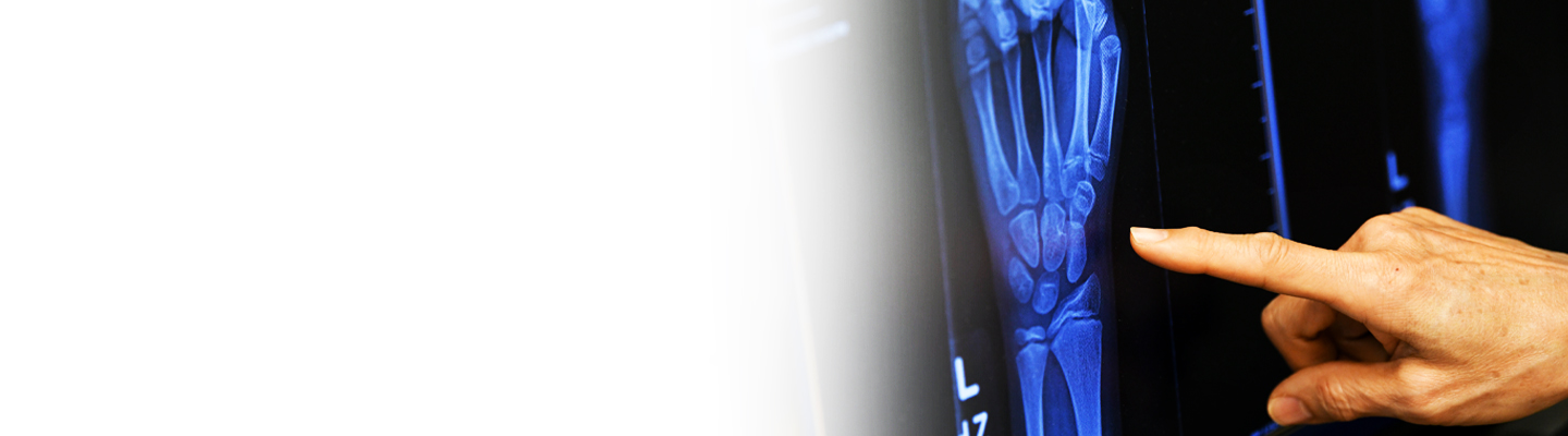 A rheumatologist pointing to a close-up of a hand X-ray.