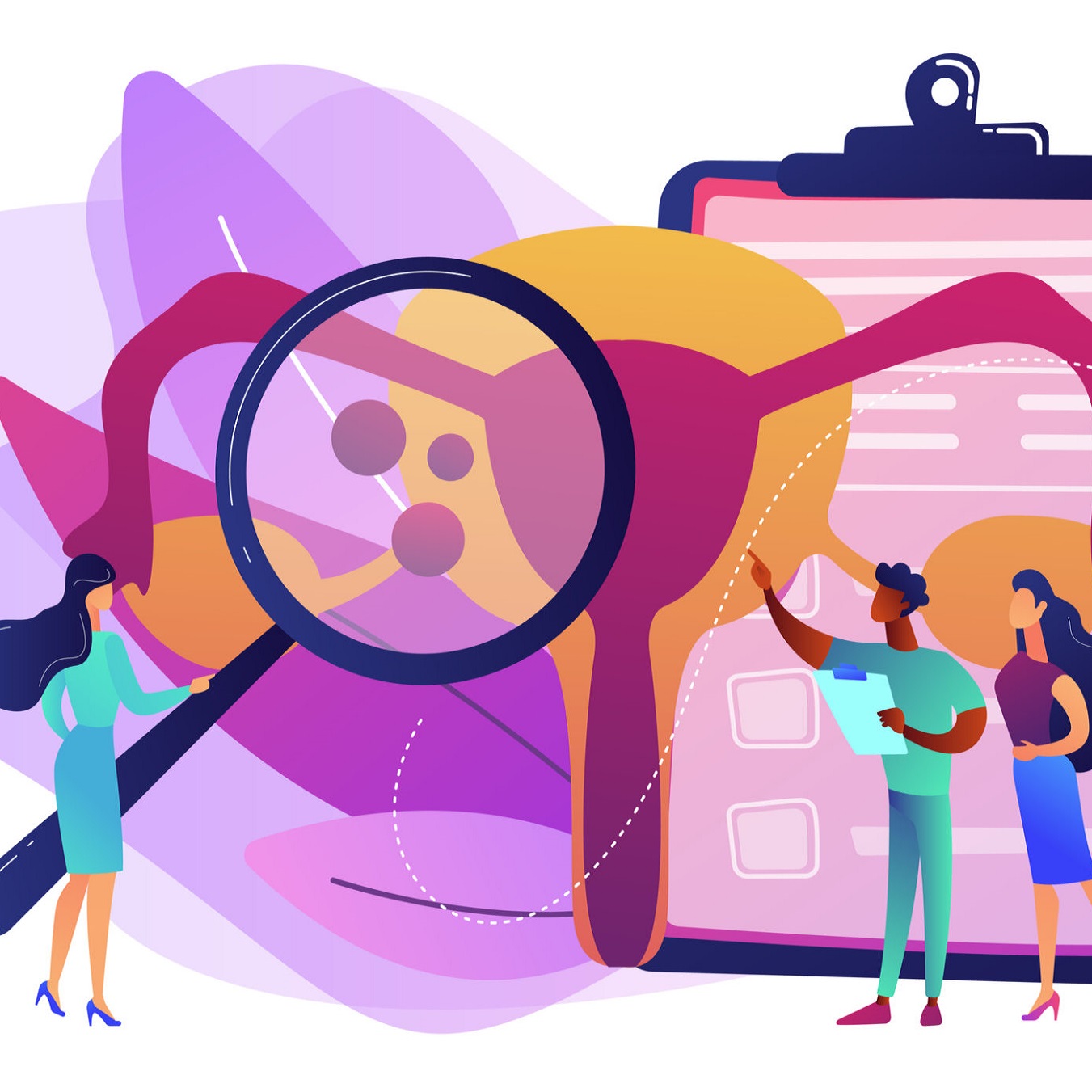 Endometriosis / uterus graphic