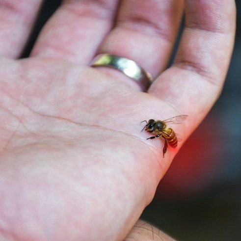 How to Treat Common Stings