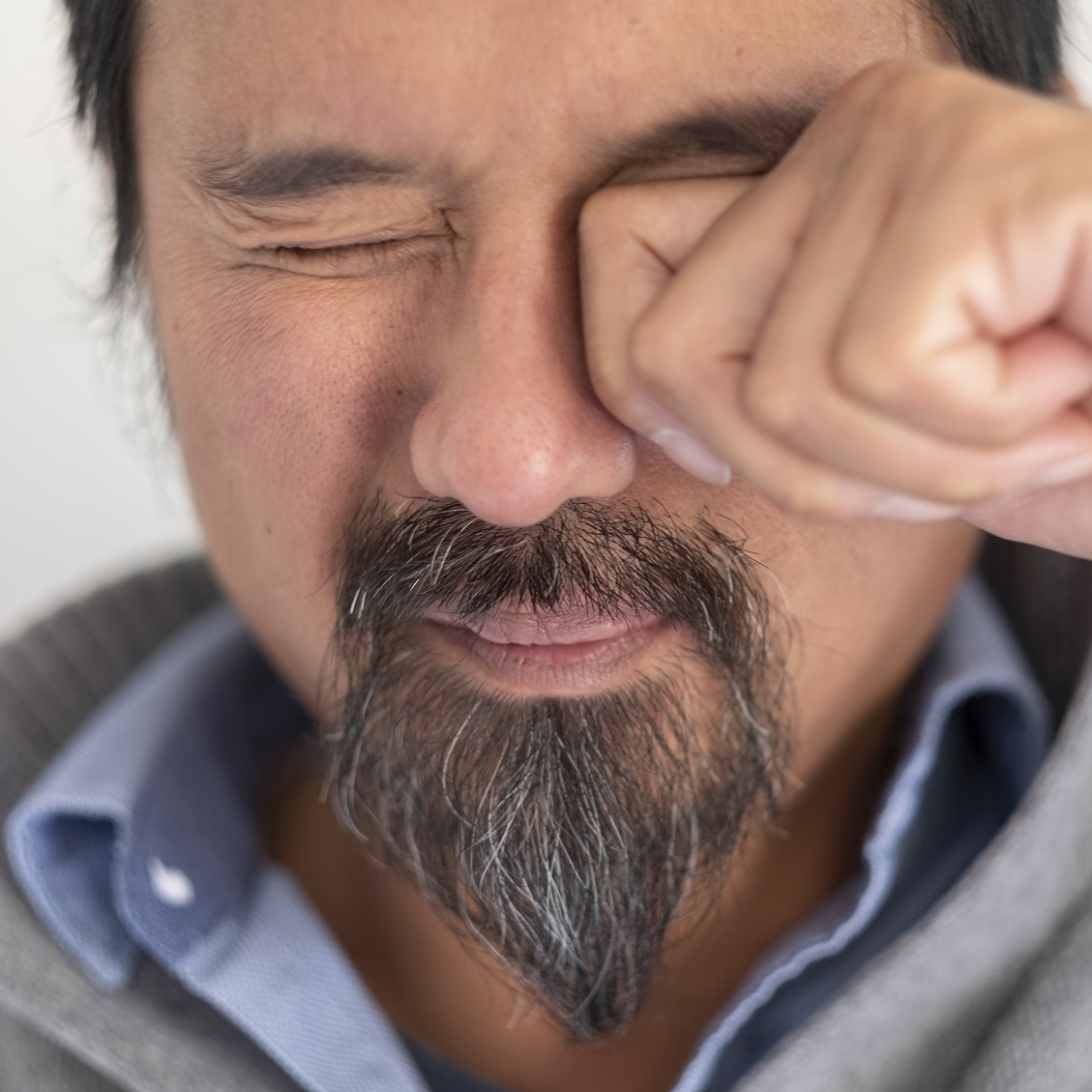 Are Itchy Eyes a Sign of COVID?