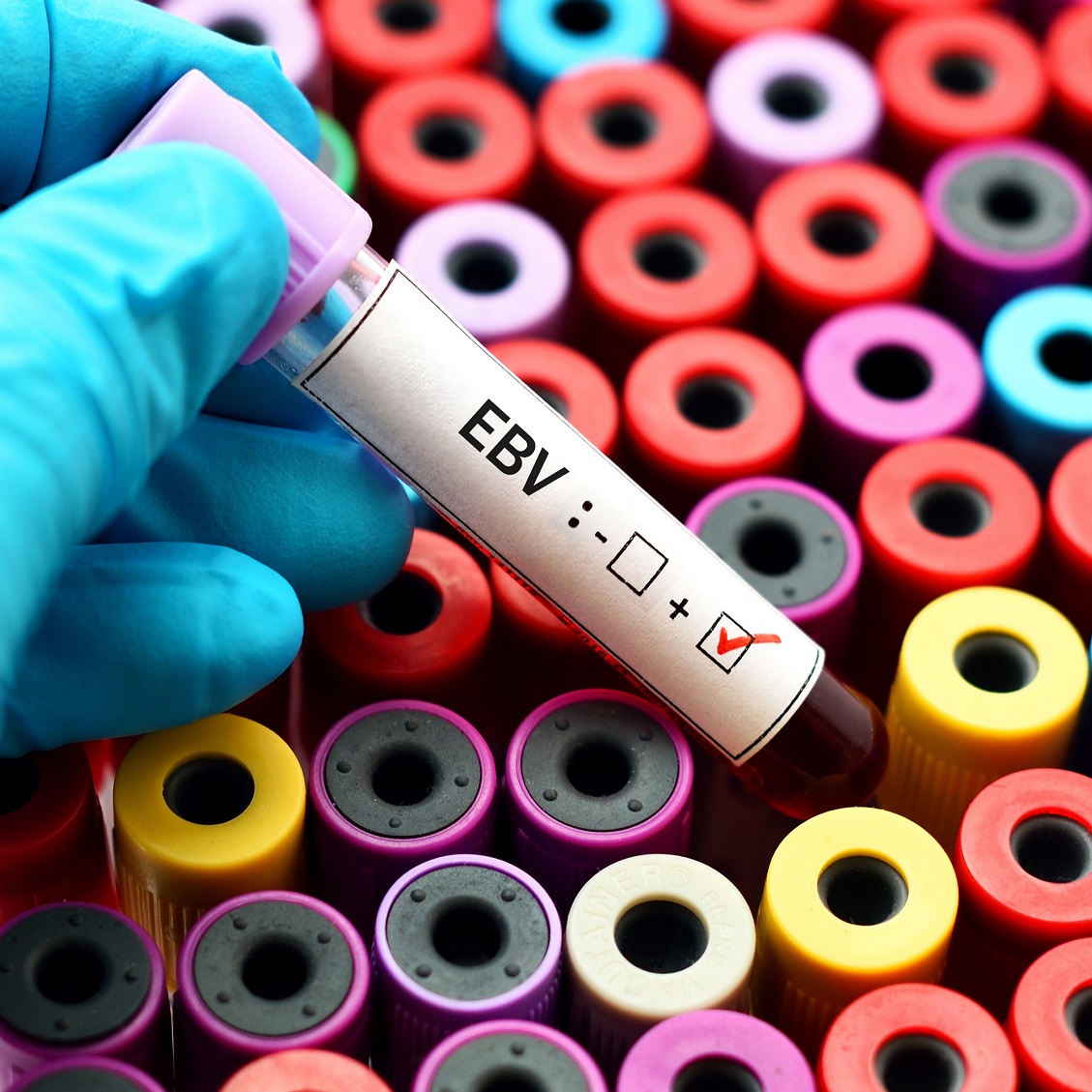 hand holding laboratory test tube