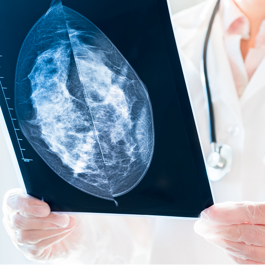 Female doctor looking at mammography results on x-ray.
