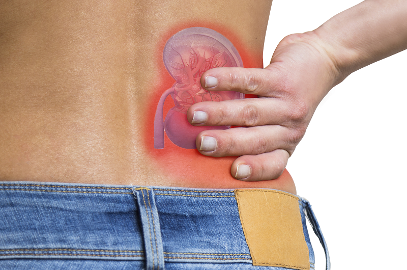 Woman clenching back for pain from kidney stones, an image of a kidney shown