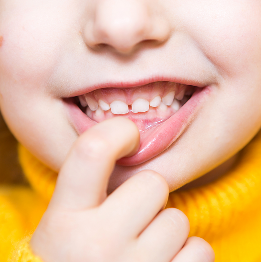 Close up, young girl shows her teeth, pulling down her bottom lip, showing her overbite.