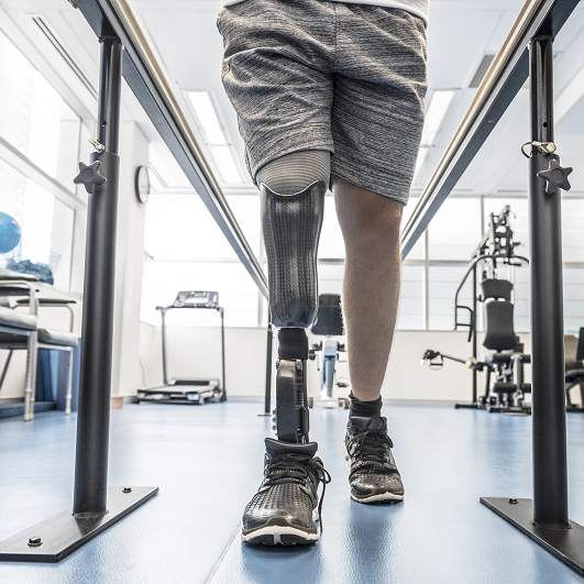 Man with prosthetic leg walking and exercising through rehabilitation and physical therapy.
