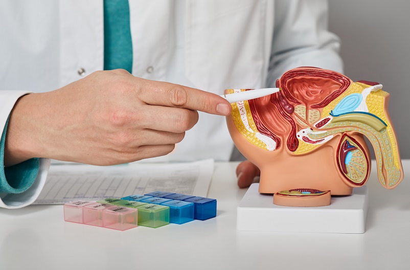 doctor pointing toward prostate