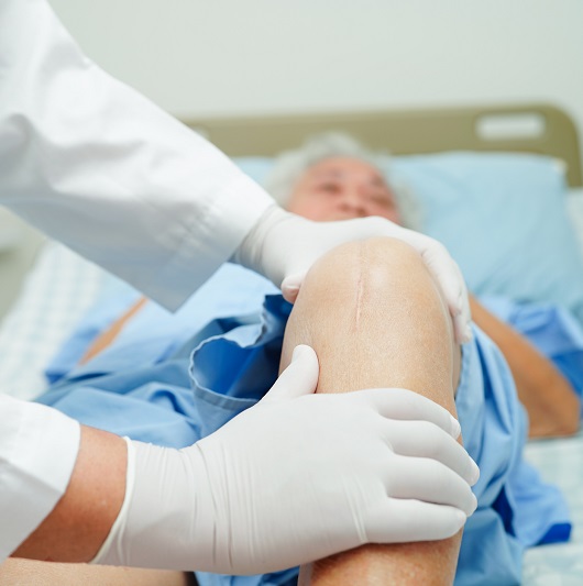 recovering knee replacement patient