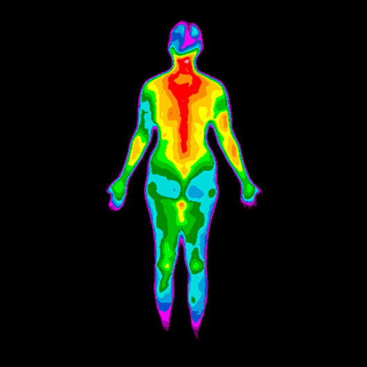 Thermographic photo of the back of the whole body of a woman with the photo showing different temperatures in a range of colors.