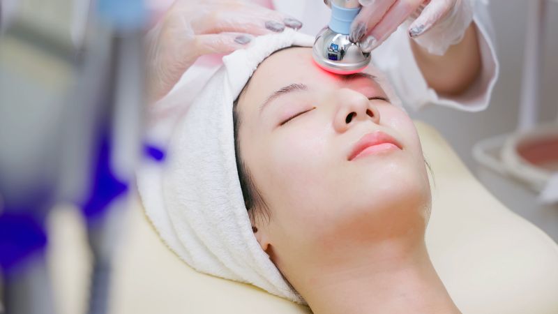 Image shows a close-up of a woman receiving a non-surgical laser treatment on her face.