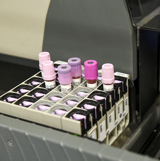 Vials in a lab for genetic testing.