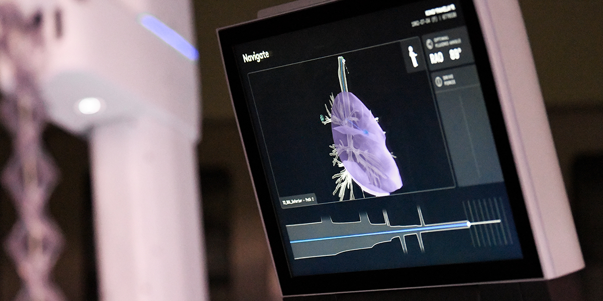 Medical image on computer screen