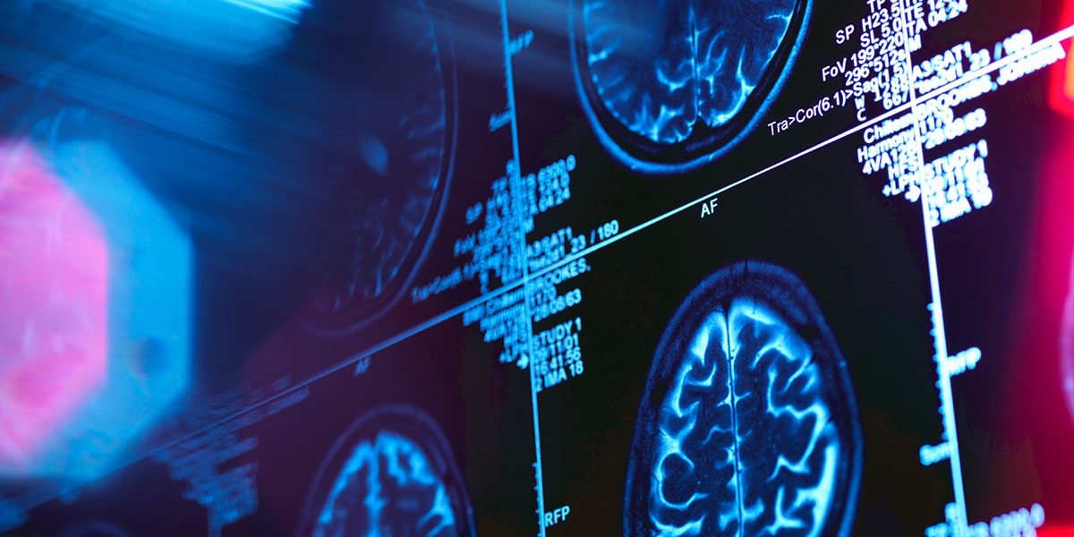 Anti Seizure Medication