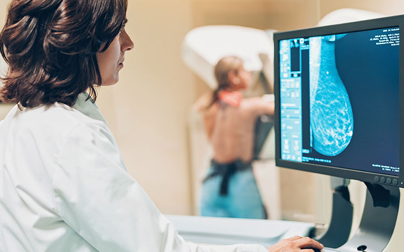Mammography