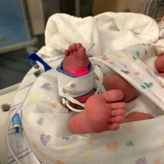 Close up of hospitalized baby's feet, with a heart monitor wrapped around their foot. Baby in the NICU.