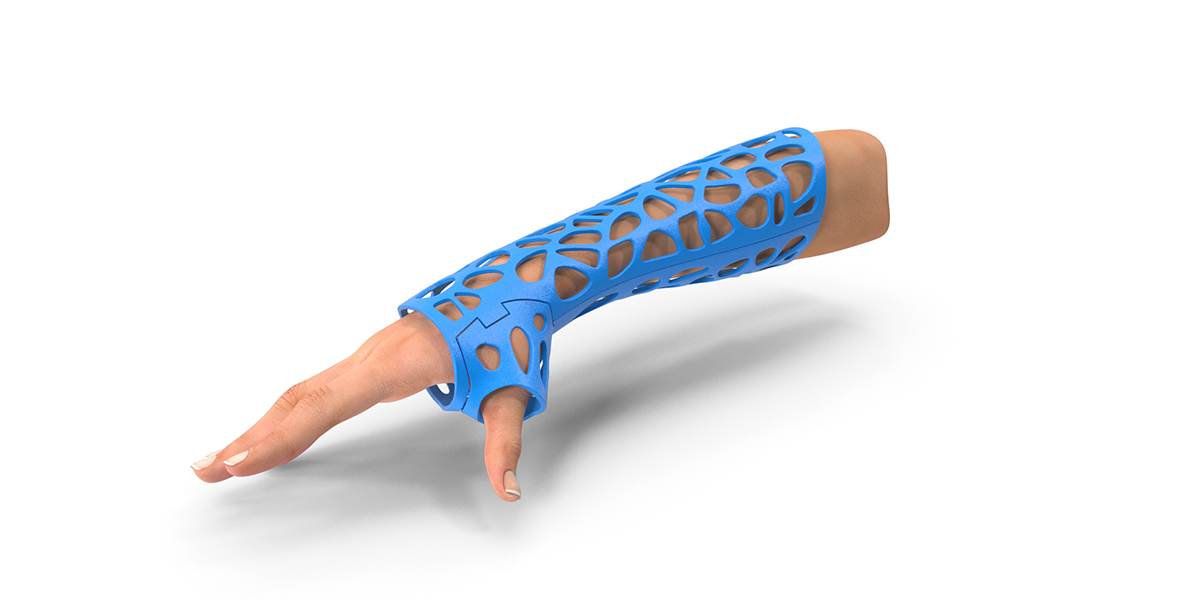 Orthosis Material Properties